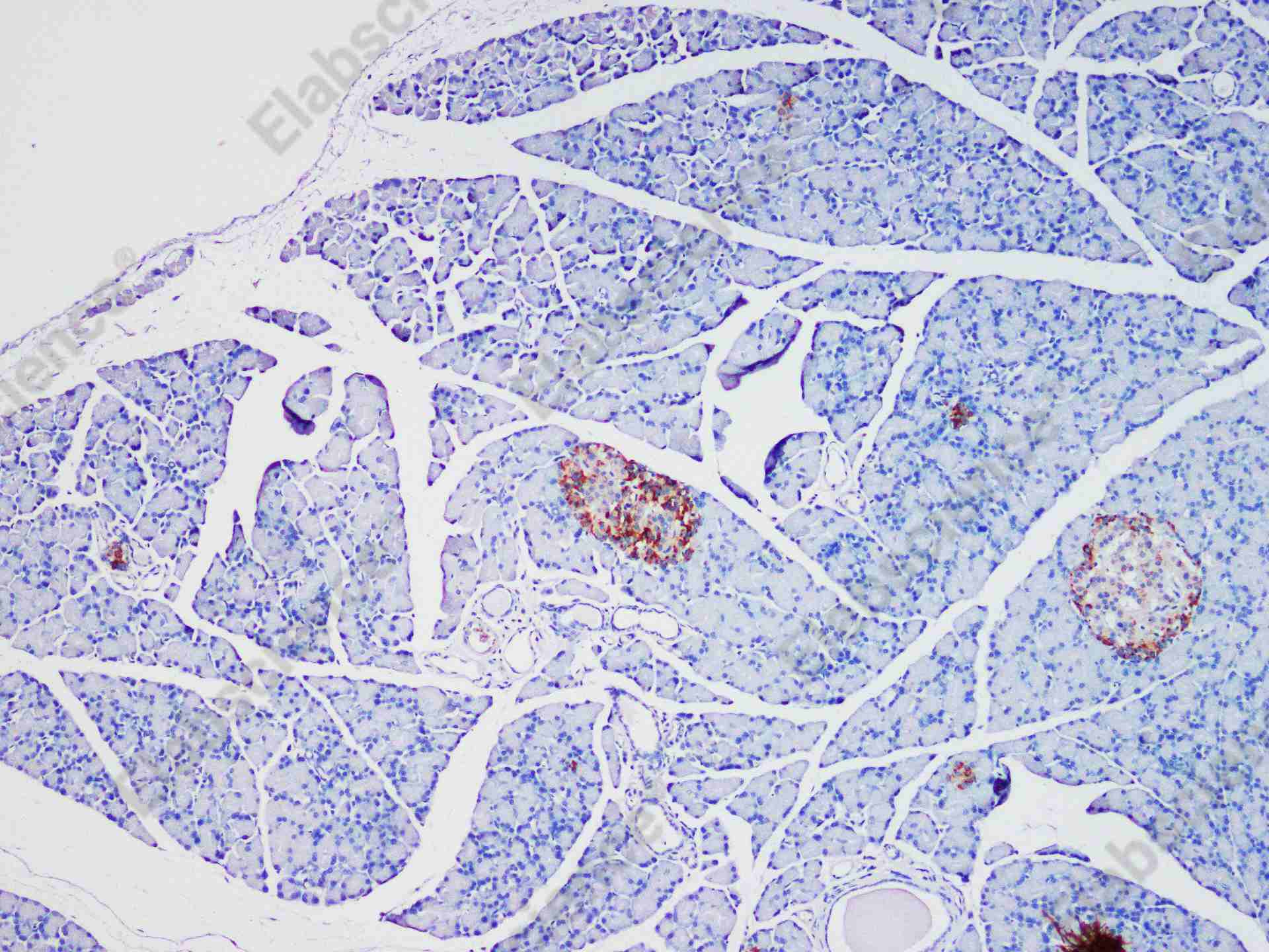 Recombinant Chromogranin A/CHGA/CGA Monoclonal Antibody - 3
