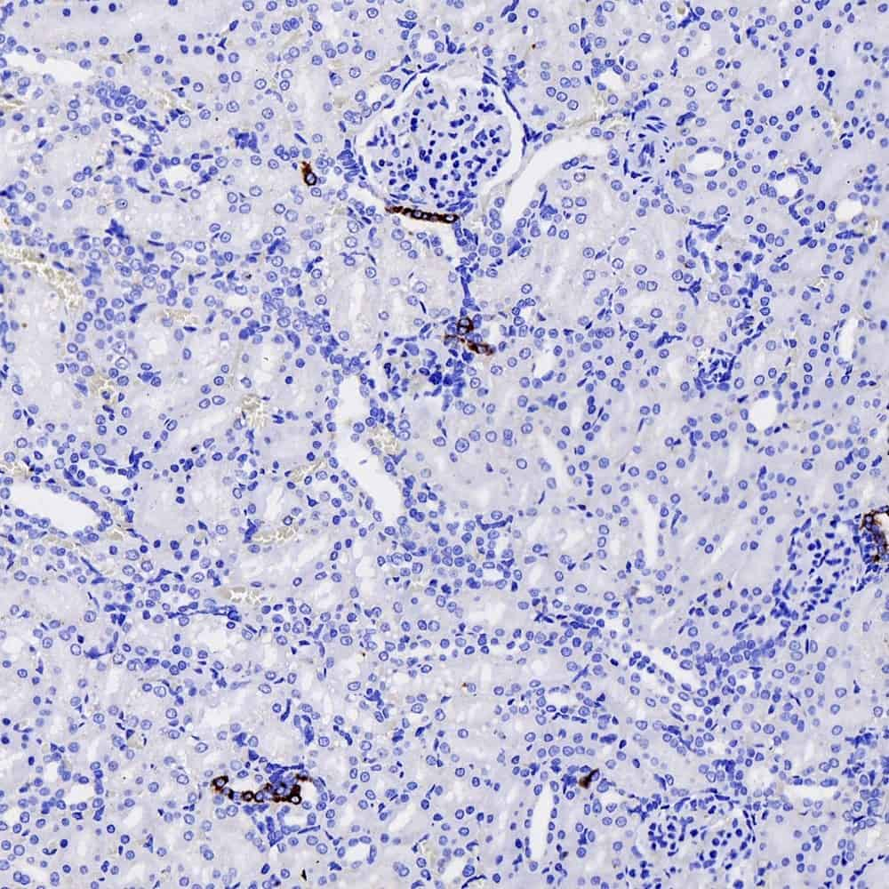 Immunohistochemistry analysis of paraffin-embedded Rat nephritis  using COX2 Polyclonal Antibody at dilution of 1:500.