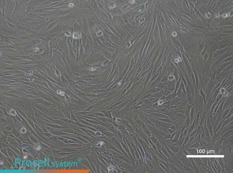 Human Gingival Fibroblast Complete Medium - 1