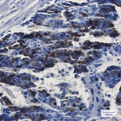 Recombinant MMP14 Monoclonal Antibody - 2