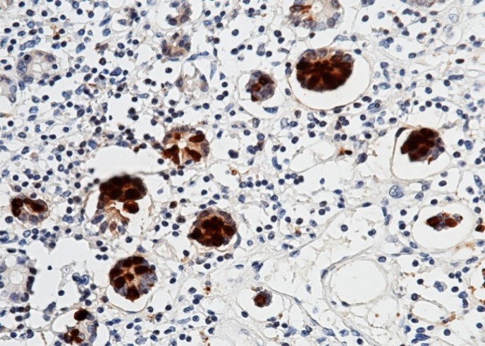 Recombinant REG3A Monoclonal Antibody - small - 1