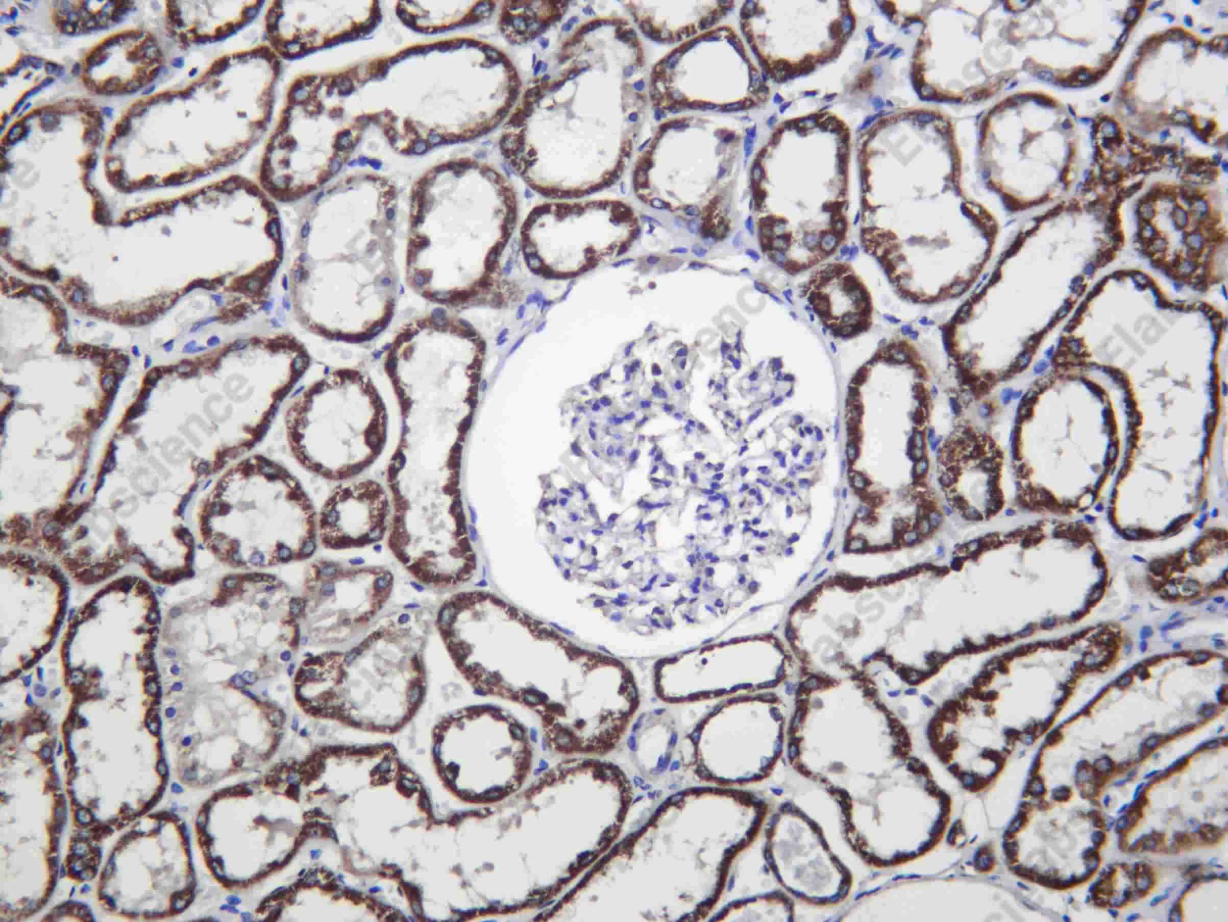 Recombinant ECHA Monoclonal Antibody - 1