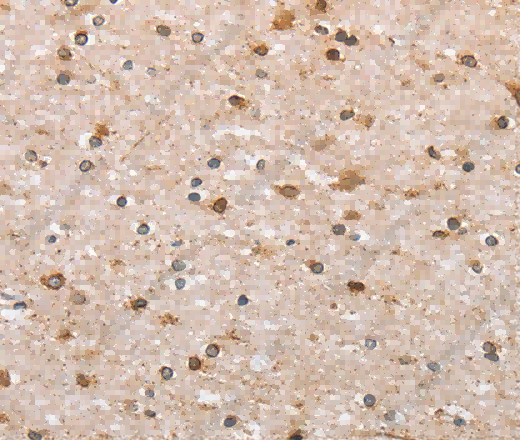 CANX Polyclonal Antibody - 3