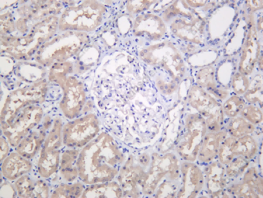 Recombinant SOCS-1 Monoclonal Antibody - 1