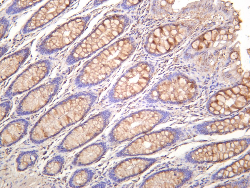 Recombinant NF-κB p65 Monoclonal Antibody - small - 4