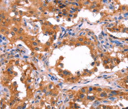 ERAS Polyclonal Antibody - 2