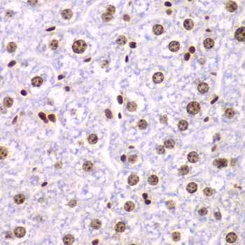 Immunohistochemistry of paraffin-embedded Mouse liver using SSRP1 Polyclonal Antibody at dilution of  1:200 (40x lens).