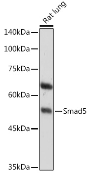 Western blot analysis of extracts of Rat lung using Smad5 Polyclonal Antibody at 1:1000 dilution.