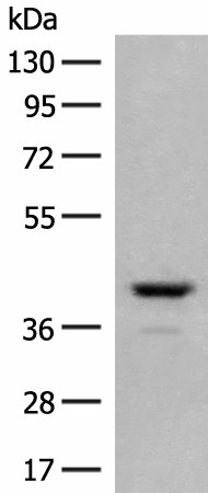 Western blot analysis of Human fetal brain tissue lysate  using TAAR2 Polyclonal Antibody at dilution of 1:350