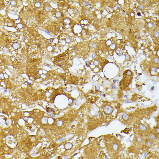 Immunohistochemistry of paraffin-embedded human liver using ITPR2 Polyclonal Antibody at dilution of 1:100 (40x lens).Perform microwave antigen retrieval with 10 mM PBS buffer pH 7.2 before commencing with IHC staining protocol.