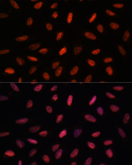 Immunofluorescence analysis of U-2 OS cells using ARID1B Polyclonal Antibody at dilution of  1:100. Blue: DAPI for nuclear staining.