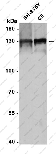 Recombinant SF3B3 Monoclonal Antibody - 1