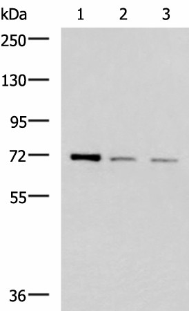 Western blot analysis of K562 HepG2 and Jurkat cell lysates  using FOXK1 Polyclonal Antibody at dilution of 1:400