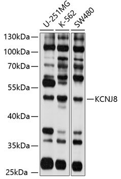 Western blot analysis of extracts of various cell lines using KCNJ8 Polyclonal Antibody at 1:1000 dilution.