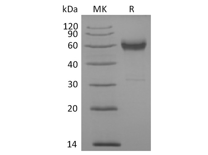 Recombinant Cynomolgus 4-1BB/TNFRSF9/CD137 Protein (Fc Tag)