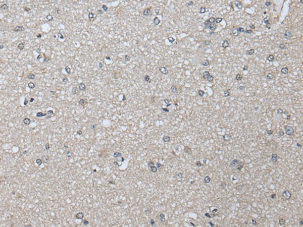 Immunohistochemistry of paraffin-embedded Human brain tissue  using PRAME Polyclonal Antibody at dilution of 1:65(?200)