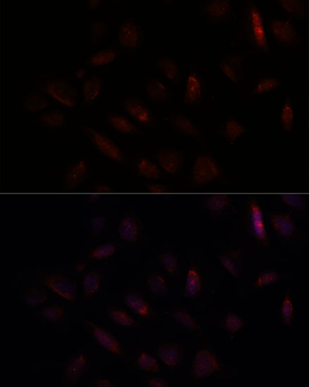 Immunofluorescence analysis of U-2 OS cells using BRCA1 Polyclonal Antibody at dilution of 1:100. Blue: DAPI for nuclear staining.