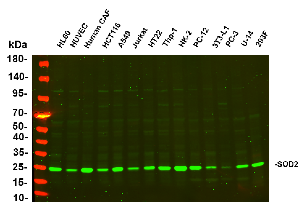 Recombinant SOD2 Monoclonal Antibody - 2