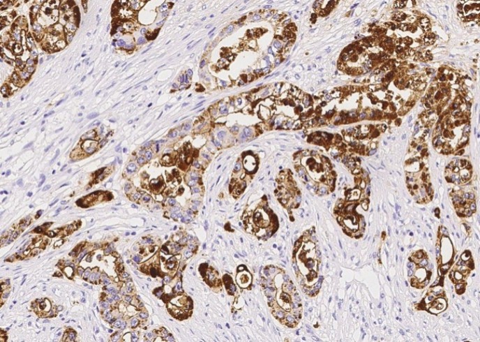 Recombinant TSPAN1 Monoclonal Antibody - small - 2