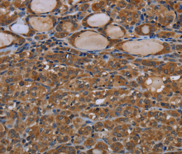GJB4 Polyclonal Antibody - 2