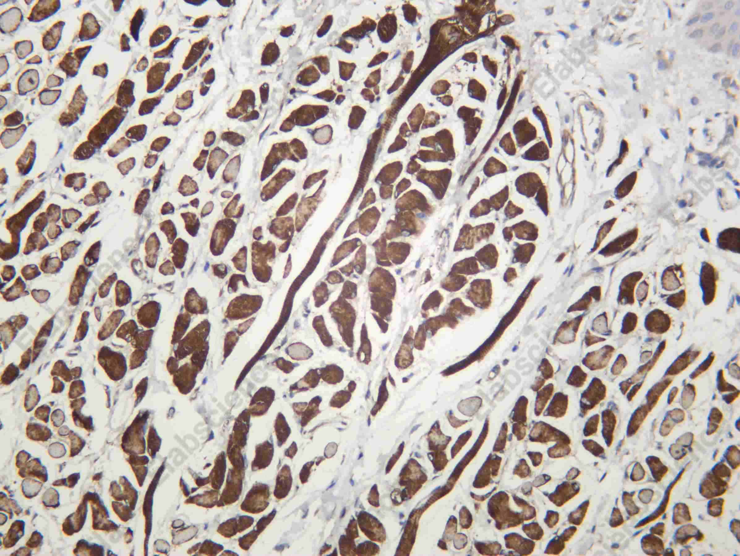 Recombinant Amphiphysin II Monoclonal Antibody - 3