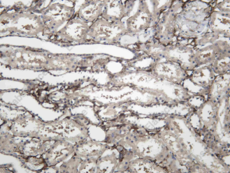 Recombinant S5A2 Monoclonal Antibody - 1