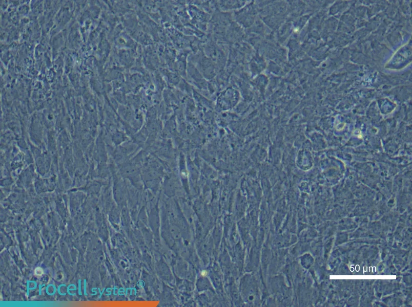 Rat Scleral Fibroblast Complete Medium - 6