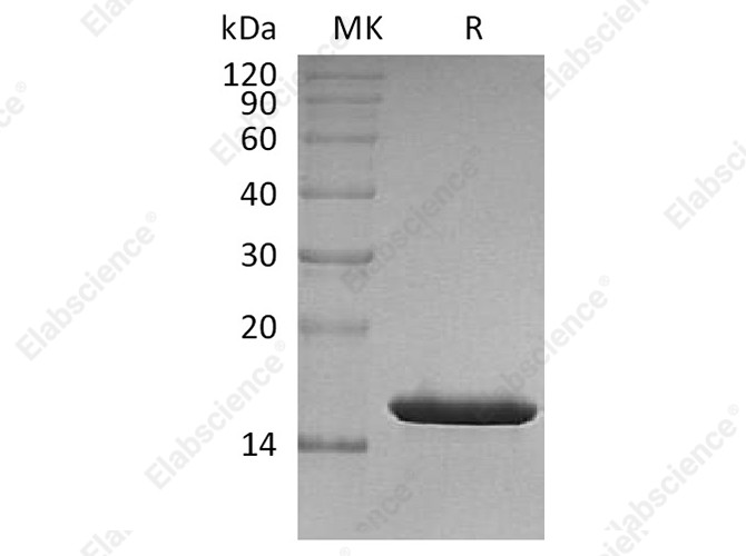 Recombinant Human FABP4/A-FABP Protein (His Tag) - 1