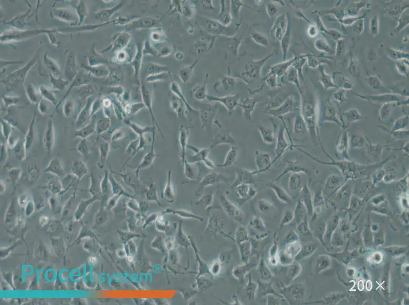 HBE135-E6E7 Cell Complete Medium - small - 5