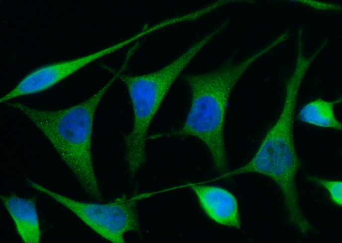 Recombinant Renin/REN/Angiotensinogenase Monoclonal Antibody-searchlist-1