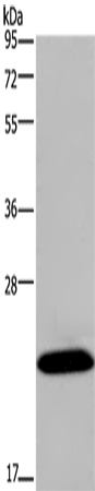 Western Blot analysis of Mouse brain tissue using KCNMB4 Polyclonal Antibody at dilution of 1:500