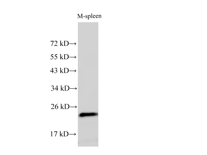 Western Blot analysis of Mouse spleen using RAN Polyclonal Antibody at dilution of 1:500