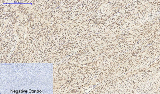 Immunohistochemistry of paraffin-embedded Human uterus tissue using LMNA Polyclonal Antibody at dilution of 1:200.