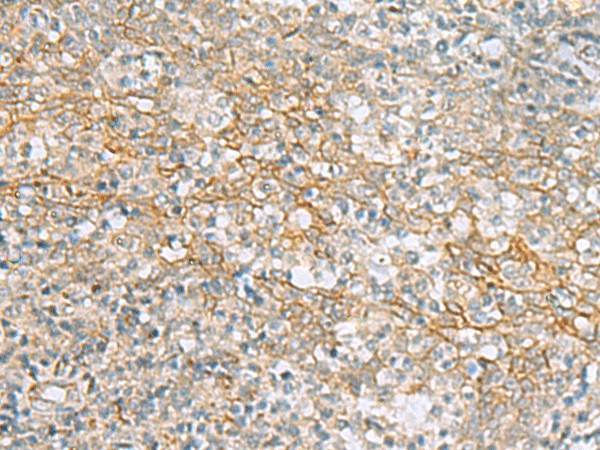 Immunohistochemistry of paraffin-embedded Human tonsil tissue  using KCNH7 Polyclonal Antibody at dilution of 1:60(?200)