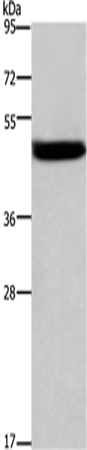 Western Blot analysis of Mouse stomach tissue using Cathepsin E Polyclonal Antibody at dilution of 1:525