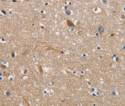 Immunohistochemistry of paraffin-embedded Human brain  tissue using CBY1 Polyclonal Antibody at dilution 1:60