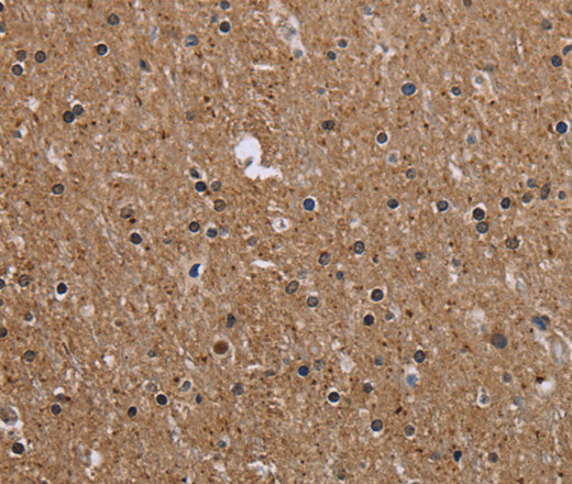 Immunohistochemistry of paraffin-embedded Human brain tissue using CMTM5 Polyclonal Antibody at dilution 1:40