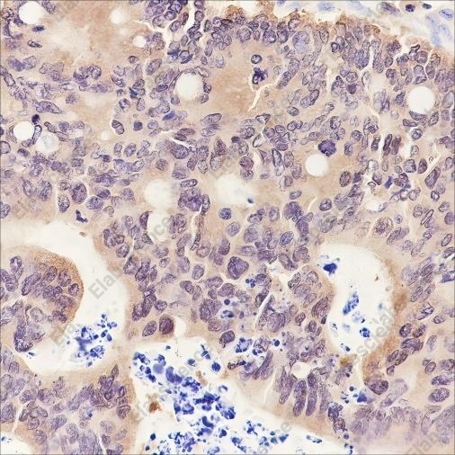 Recombinant PPM1A Monoclonal Antibody - 2
