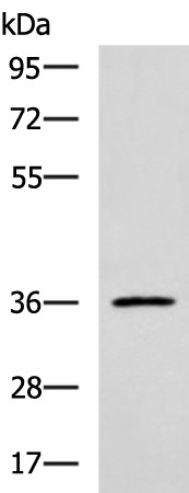 Western blot analysis of Jurkat cell lysate  using IBSP Polyclonal Antibody at dilution of 1:700