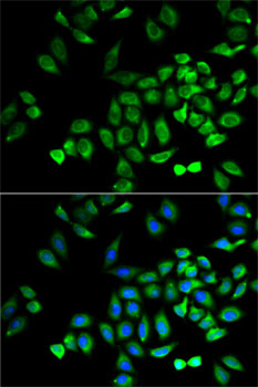 Immunofluorescence analysis of A-549 cells using ANGPTL4 Polyclonal Antibody