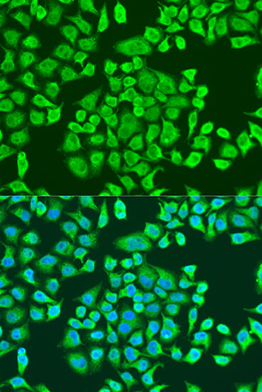 Immunofluorescence analysis of U2OS cells using IGF2BP3 Polyclonal Antibody at dilution of  1:100. Blue: DAPI for nuclear staining.