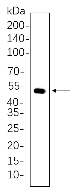 Recombinant Cytokeratin 14 Monoclonal Antibody-searchlist-1