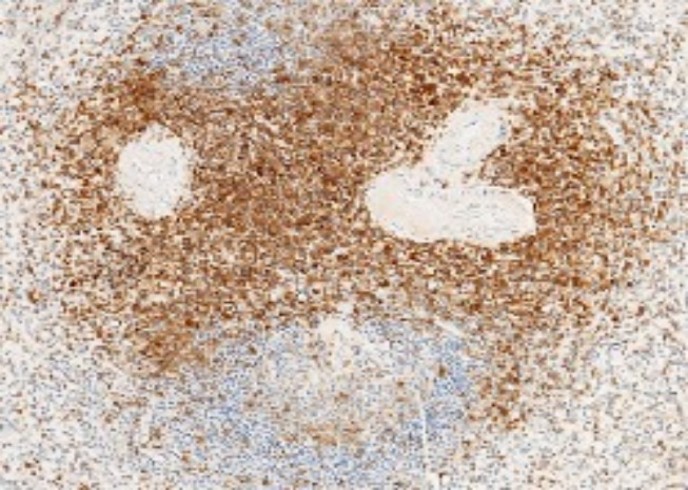 CD3d/CD3 delta Monoclonal Antibody - small - 2