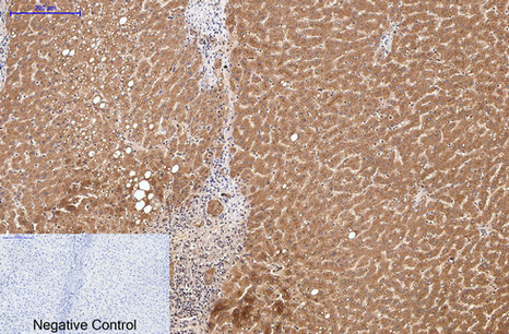 Immunohistochemistry of paraffin-embedded Human liver tissue using COL3A1 Monoclonal Antibody at dilution of 1:200.