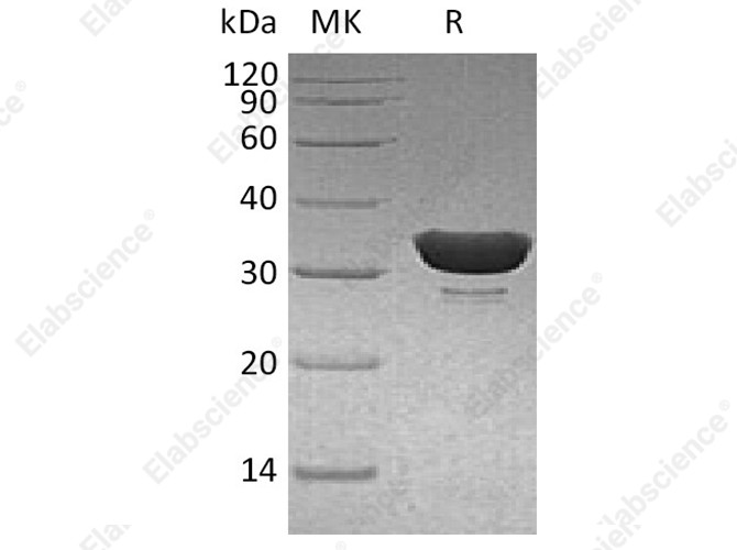 Recombinant Human DCUN1D1 Protein (His Tag) - 1