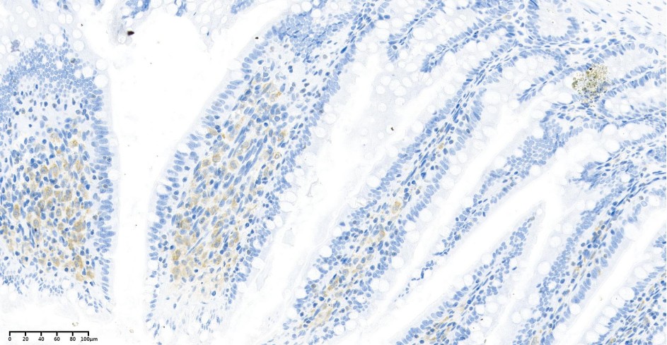 Recombinant TGF β1 Monoclonal Antibody - small - 2