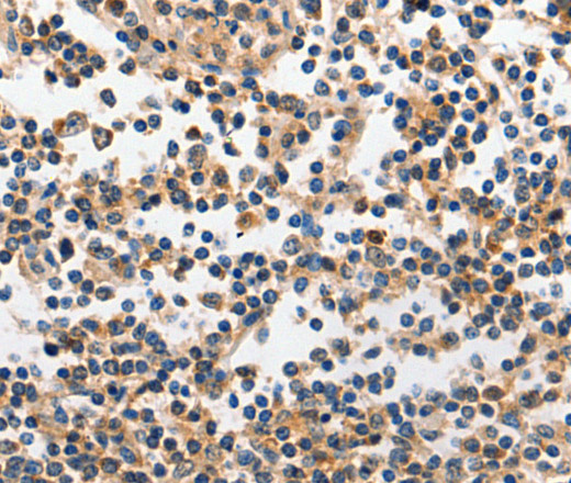 Immunohistochemistry of paraffin-embedded Human tonsil tissue using INHA Polyclonal Antibody at dilution 1:120