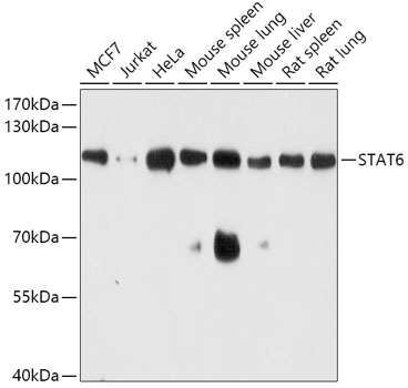 Western blot analysis of extracts of various cell lines using STAT6 Polyclonal Antibody at dilution of 1:1000.