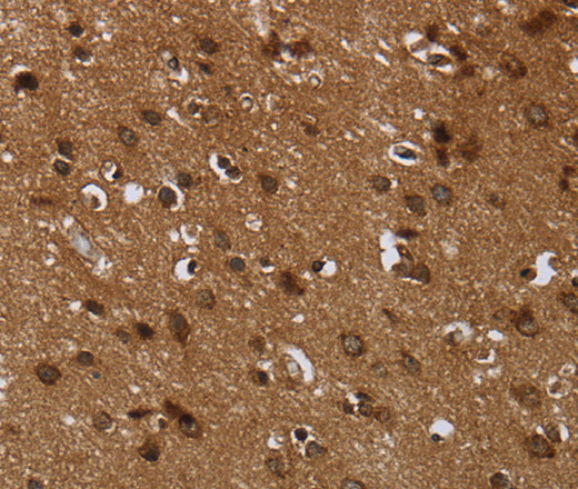 Immunohistochemistry of paraffin-embedded Human brain  tissue using CERS6 Polyclonal Antibody at dilution 1:35