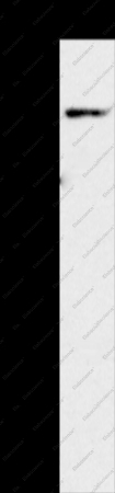 KCNQ5 Polyclonal Antibody - 1